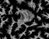 Etched Nanopillars Kill Bacteria, Fungi on Titanium Implants