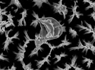 Etched Nanopillars Kill Bacteria, Fungi on Titanium Implants