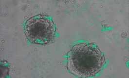 CRISPR-Equipped Bacteria Detect Tumors